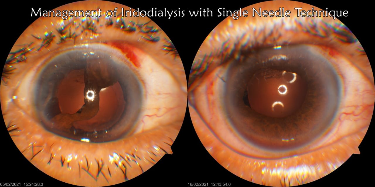 Trauma and Oculoplasty Services — Bapaye Eye Hospital, Nashik