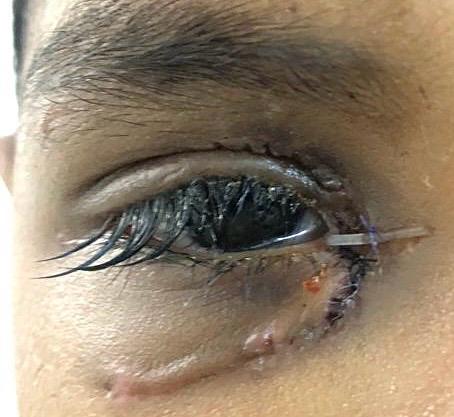 Trauma and Oculoplasty Services — Bapaye Eye Hospital, Nashik