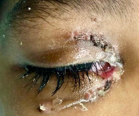 Trauma and Oculoplasty Services — Bapaye Eye Hospital, Nashik