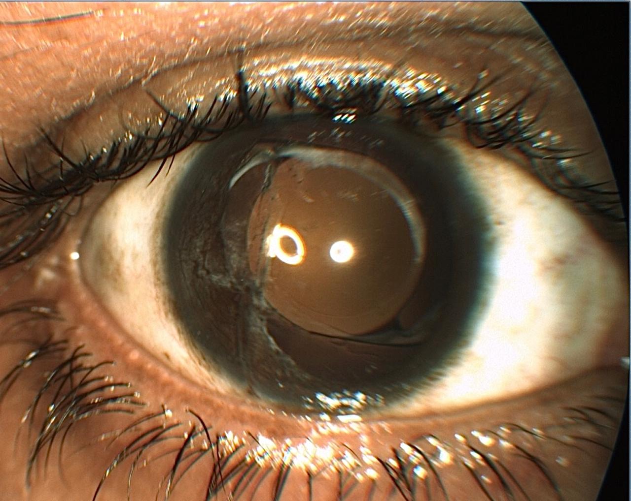 Trauma and Oculoplasty Services — Bapaye Eye Hospital, Nashik