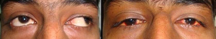Pediatric Ophthalmology — Bapaye Eye Hospital, Nashik
