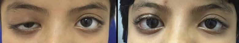 Trauma and Oculoplasty Services — Bapaye Eye Hospital, Nashik