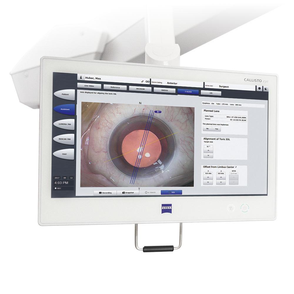 CATARACT TREATMENT IN NASHIK — Bapaye Eye Hospital, Nashik