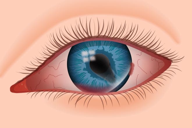 Other Services — Bapaye Eye Hospital, Nashik