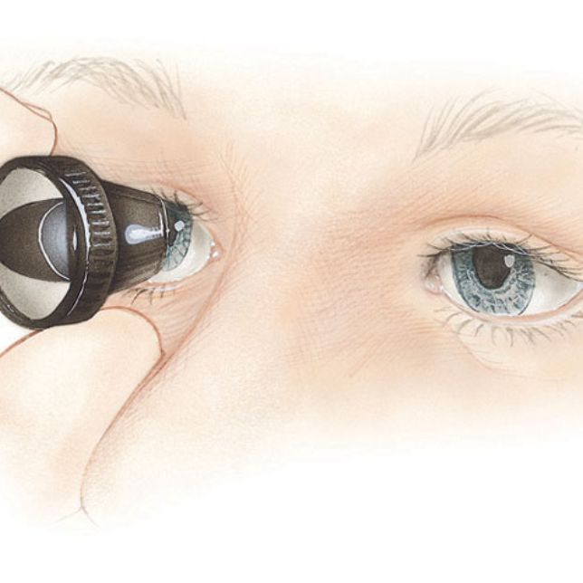 GLAUCOMA CLINIC IN NASHIK — Bapaye Eye Hospital, Nashik