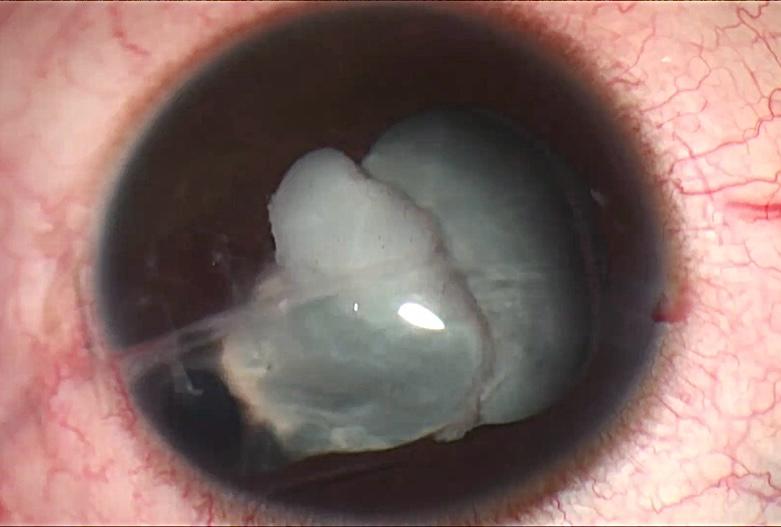 Trauma and Oculoplasty Services — Bapaye Eye Hospital, Nashik